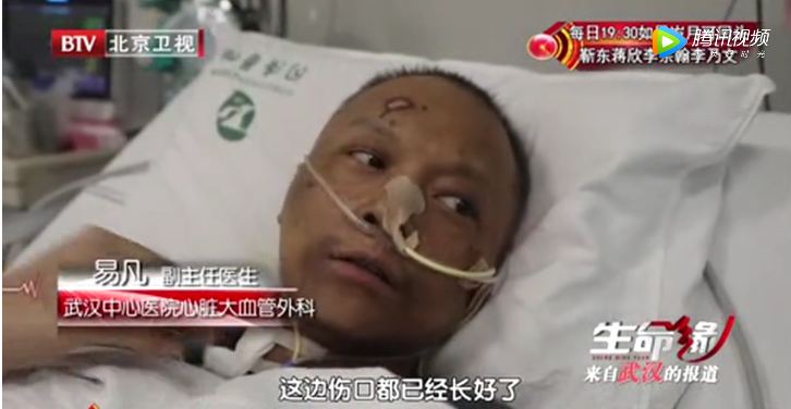 the doctor of Wuhan Central Hospital, coronavirus, turned black