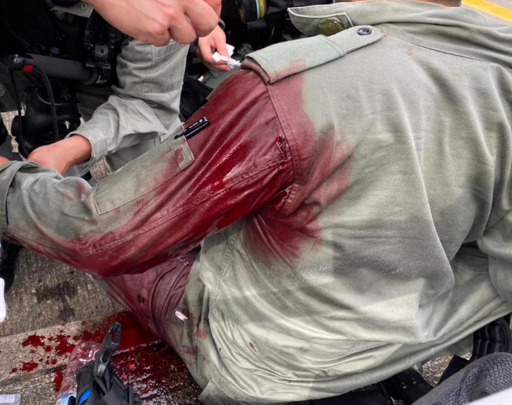 The policeman was injured and bleeds on his left shoulder, Hong Kong